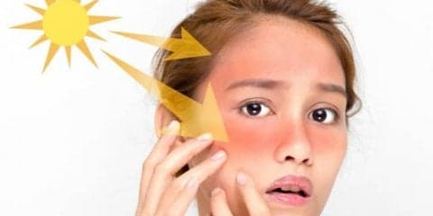 知っておきたい！日焼け後のケアでやるべきこと