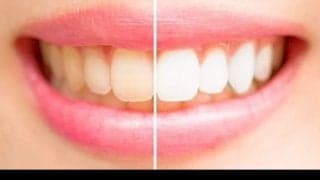 あなたもやってる？歯を黄ばませる６つの食・生活習慣とは