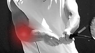 肘外側の痛み、テニス肘(上腕骨外側上顆炎)の傾向と対策(前編)[リバイバル記事]